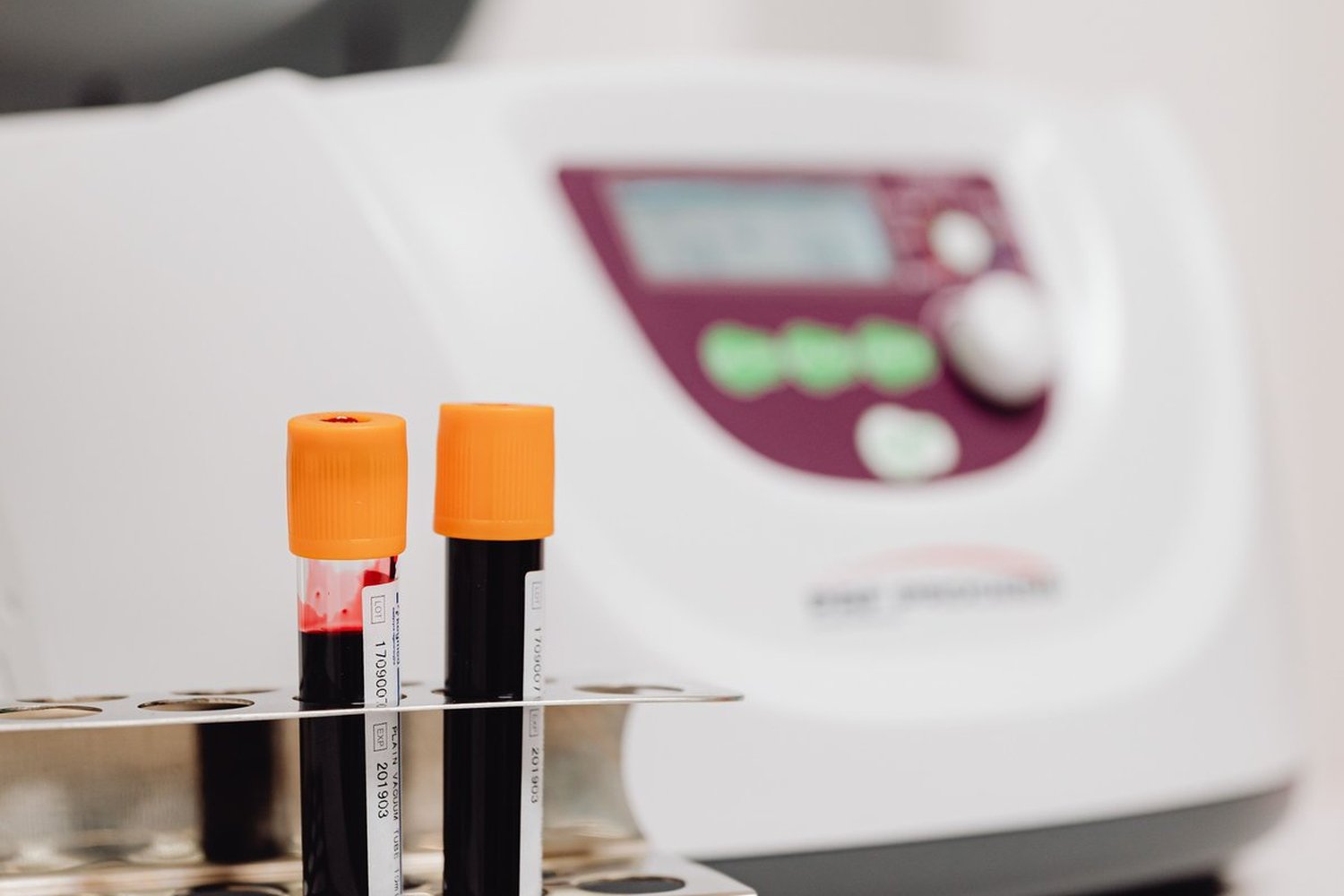 Blood sample tubes in a rack beside a laboratory centrifuge
