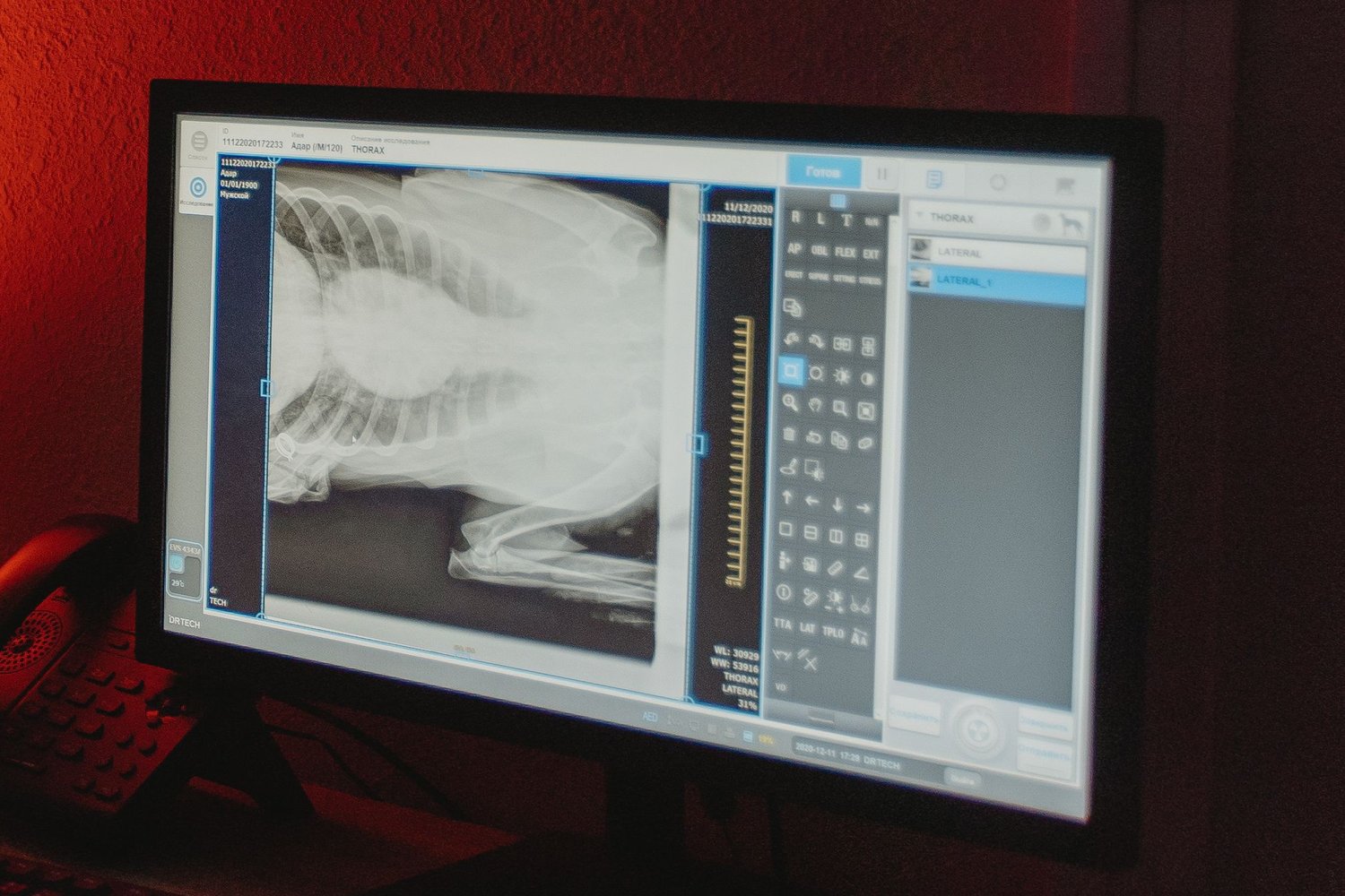 A dog's chest X-ray displayed on an imaging monitor