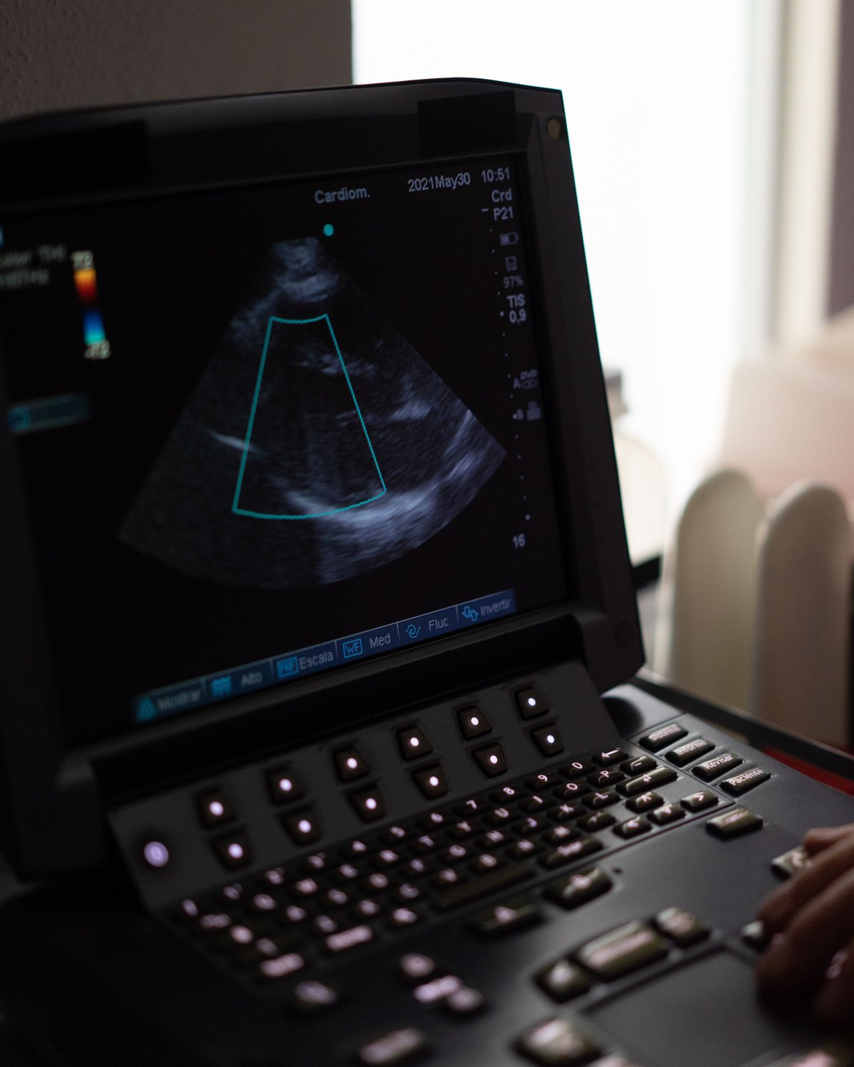 An ultrasound machine showing a heart image with colour flow on its screen